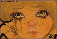 Freckles